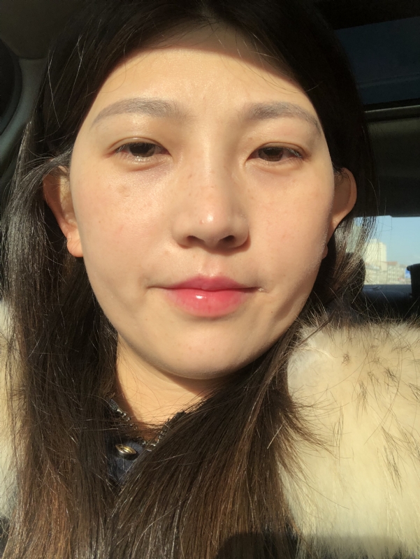 轻闭双眼的第一张照片--辽宁残疾人相亲网